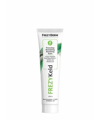 Εικόνα της FREZYDERM FREZYKELD CREAM 40ML    Frezyderm Frezykeld Cream Απαλή Κρέμα Αντιμετώπισης Ουλών, 40ml